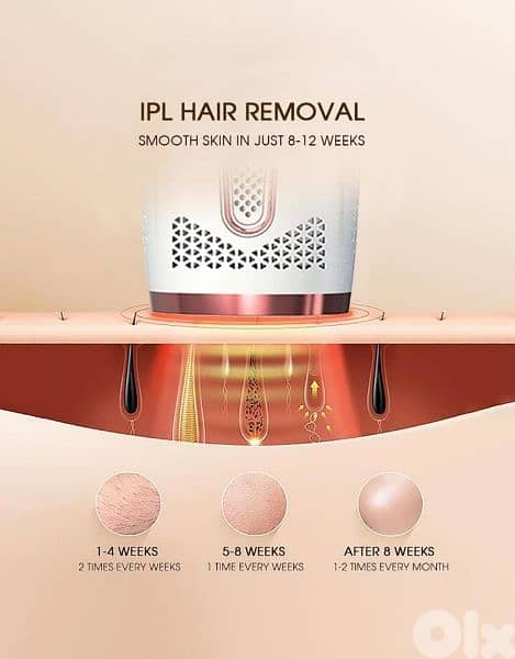 Ipl Laser Hair remover 1