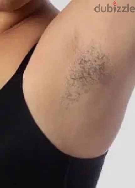 Trio/Quadro Laser Machine diode Alexandre nd yag Etm 5