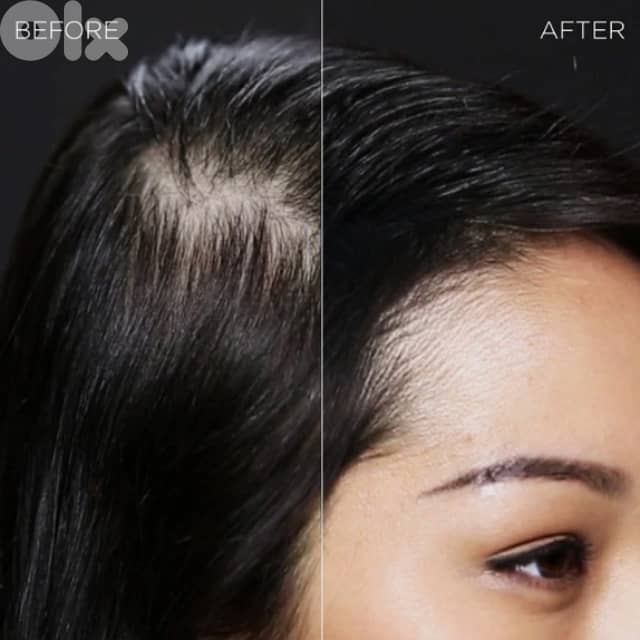 Toppik Hair Filler 3-in-1 for Thinning Hair and Receding Hairline 4