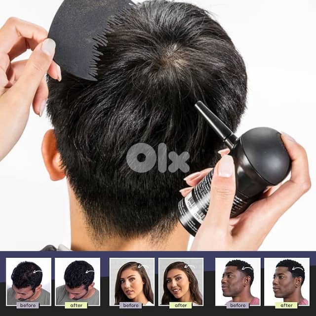 Toppik Hair Filler 3-in-1 for Thinning Hair and Receding Hairline 5