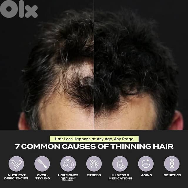 Toppik Hair Filler 3-in-1 for Thinning Hair and Receding Hairline 10