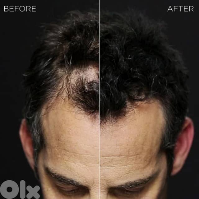 Toppik Hair Building Fibers Powder, Receding Hairline Filler Spray 2