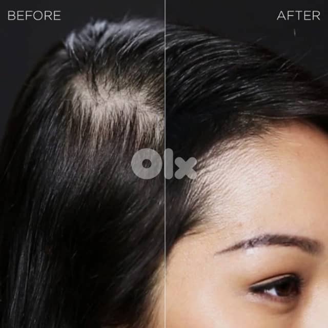 Toppik Hair Building Fibers Powder, Receding Hairline Filler Spray 4