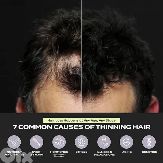 Toppik Hair Building Fibers Powder, Receding Hairline Filler Spray 12