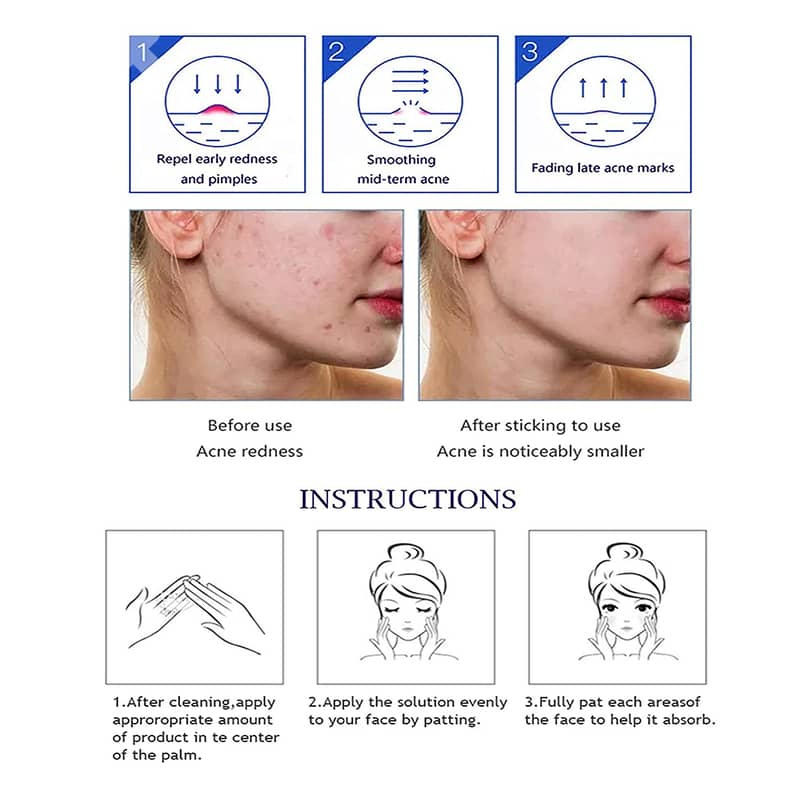 Aichun Beauty Anti-Acne Serum – Repairs, Brightens, Clears Skin (30ml) 3