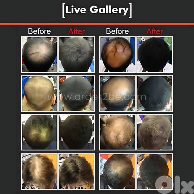 DeXe Hair Building Fibers Powder for Instantly Thicker, Fuller Hair 5