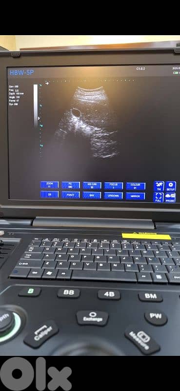 Ultrasound B/W - Laptop with battery 3