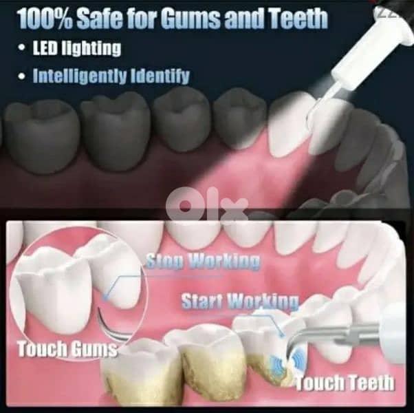 HassoKonHassokon Electric ,Plaque Remover and brush/4$ deliver 4