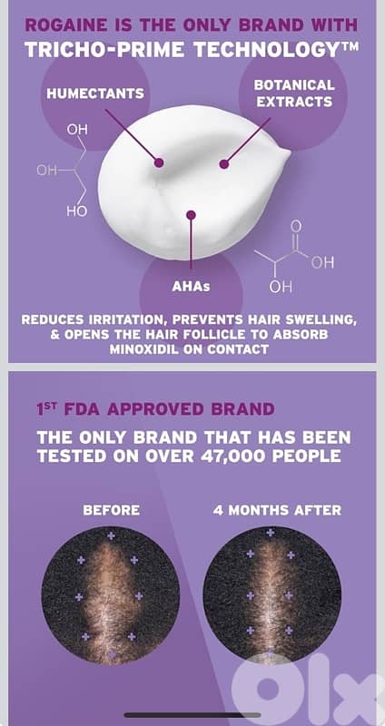 Rogaine for Wome, Growth Treatment for Thinning & Hair Loss, 1