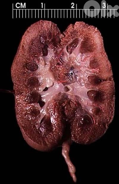 rfeeie bado yrouh aa italy mestaajlin aa masare