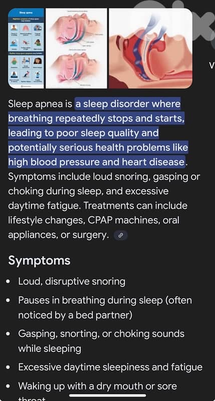 sleep apnea medical machine 0