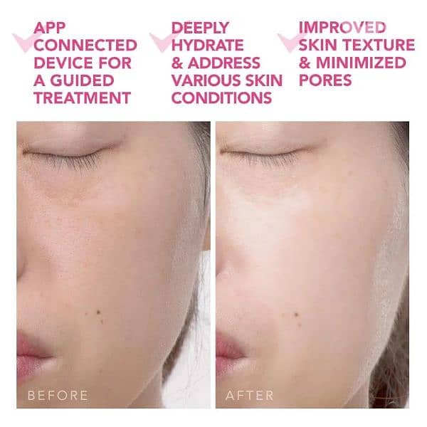 FOREO UFO 2 Heated Led Power Mask Fuchsia 4