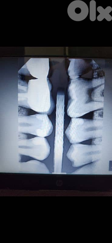 Sensor for Xray dental rvg 2