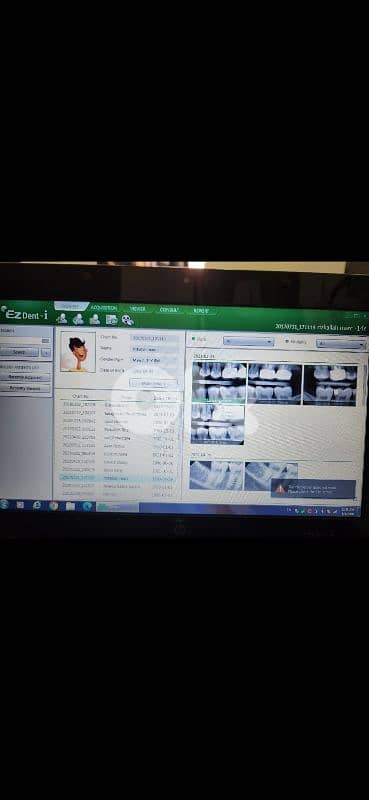 Sensor for Xray dental rvg 3