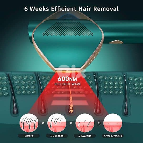 Laser Hair Removal Device, Super Fast Flash IGBT Technology 1