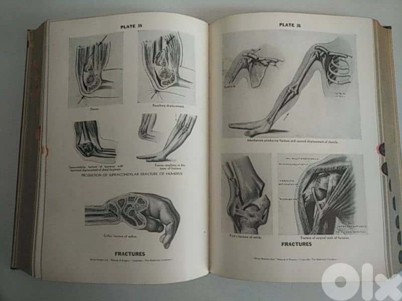 Very old Blakiston's New Gould Medical Dictionary - Not Negotiable 2