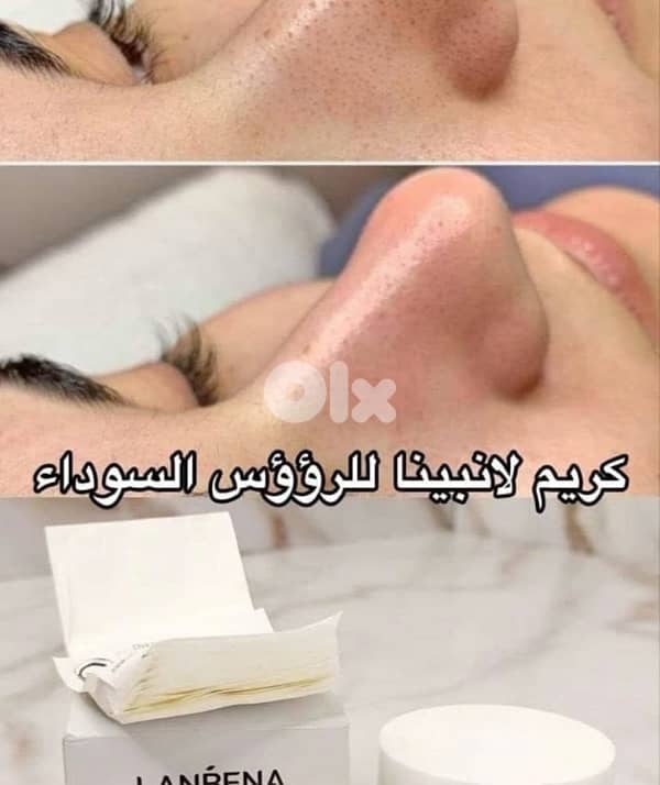 Lanbena Nose Pore Strips 1