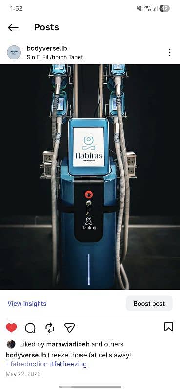 fat freezing machine