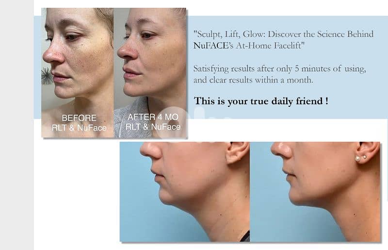 Nuface MINI face toning 6