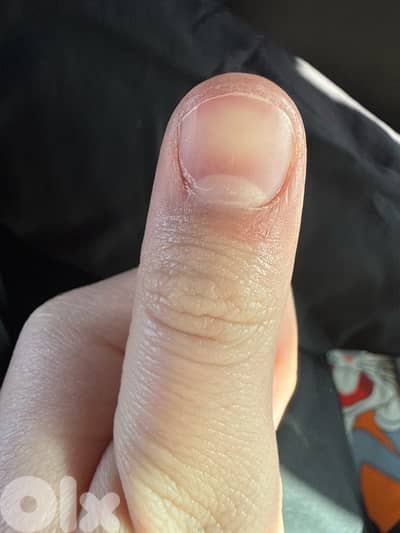 finger ( thumb) ktir ndif cut nails