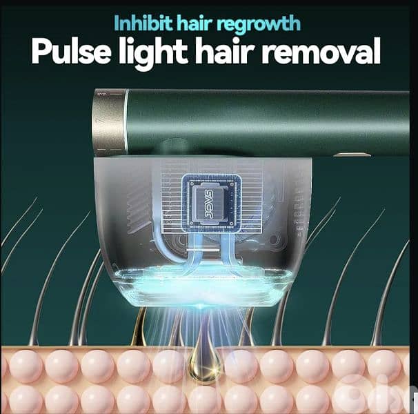 JOVS Laser Hair Removal, Venus Pro IPL with ice cooling tech 2