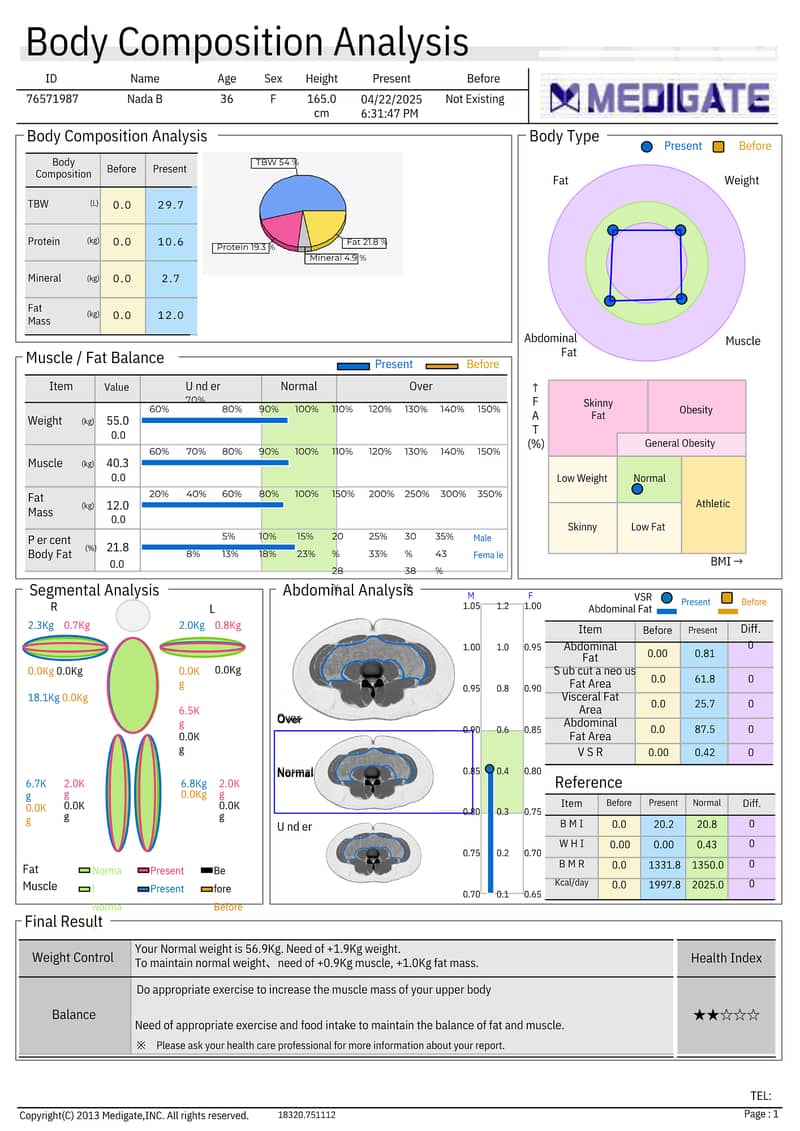 SELLING BOCA X1 BODY COMPOSITION ANALYSER 1