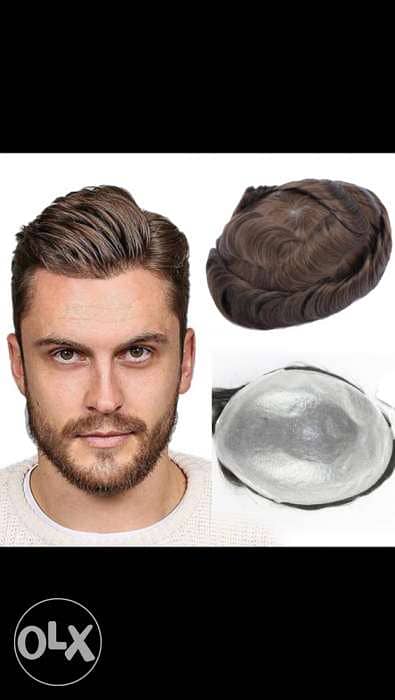 hair replacement for men 0