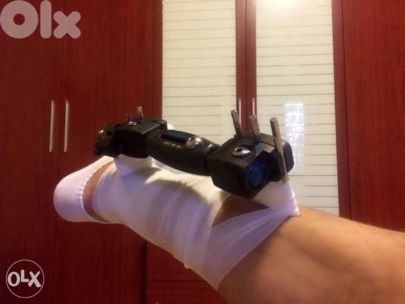 fixateur externe for tibia جهاز 2