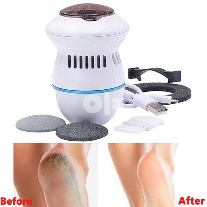 Pedi Vac Rechargeable Callus Remover – Mess-Free Foot Exfoliator 5